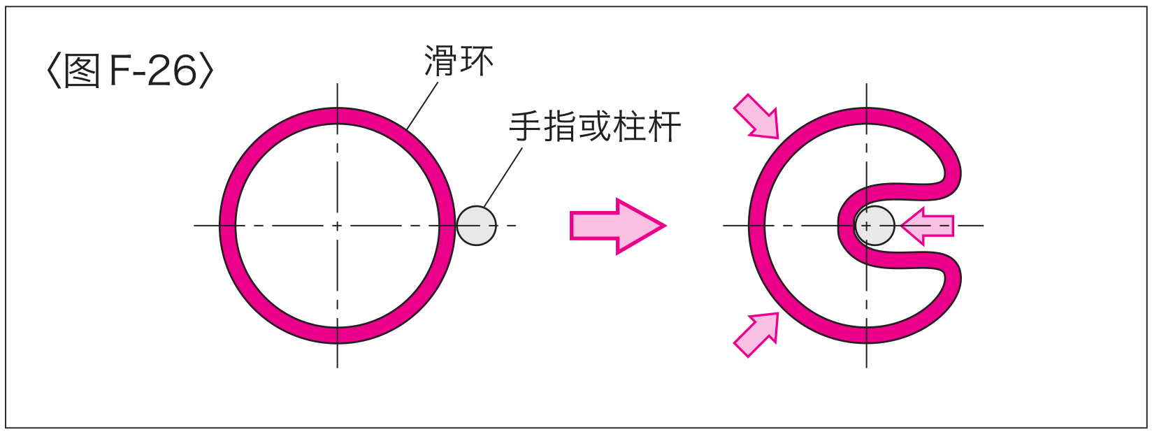 格莱圈安装图1